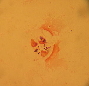 Staphylococcus aureus: Gram positive cocci und...