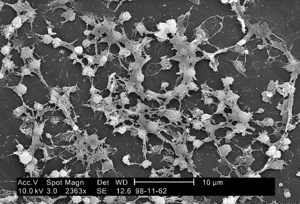 Staphylococcus on catheter